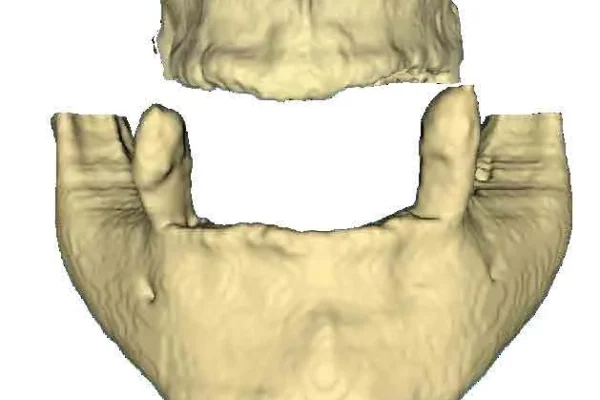 huesos de la mandibula