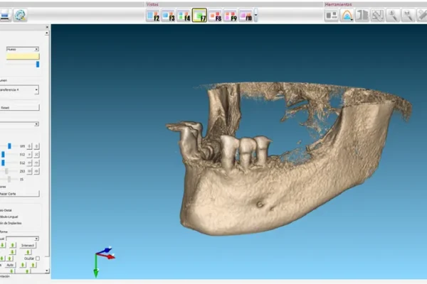 medit scanner dental