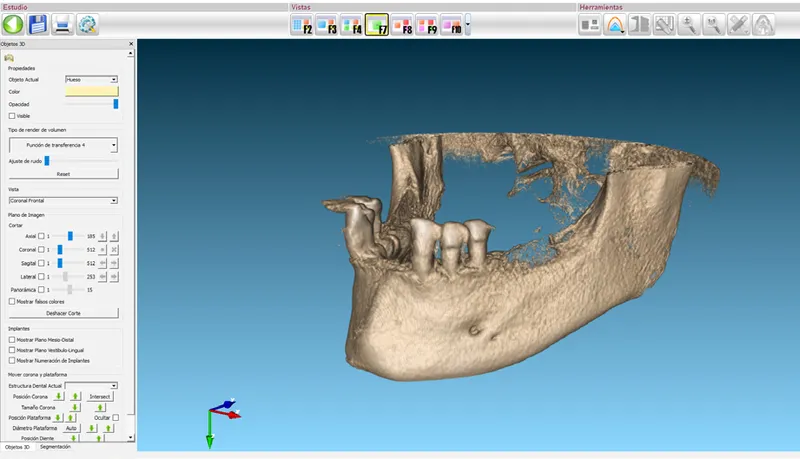 medit scanner dental