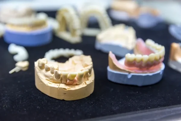 protesis fija sobre implantes