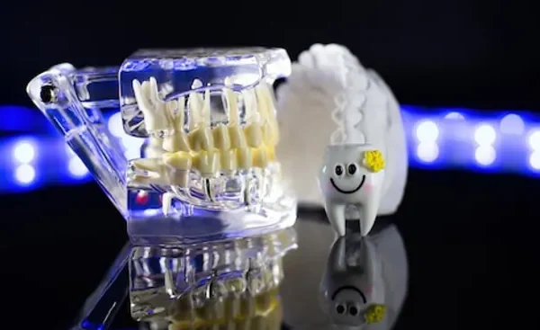 ¿Que son los implantes dentales y como funcionan