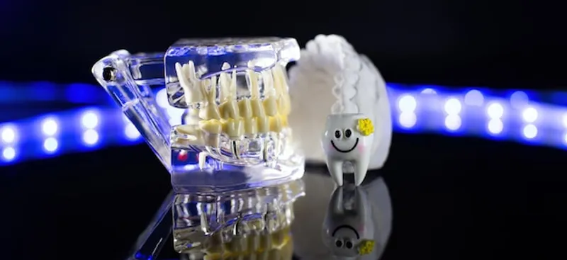 ¿Que son los implantes dentales y como funcionan