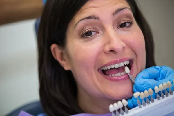 Diferencias entre implante dental y puente dental