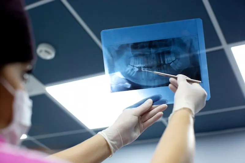 ¿Es necesario realizarse radiografias para un implante dental